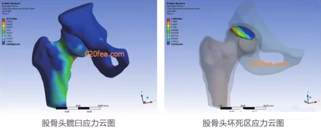 有限元分析法在結(jié)構(gòu)、醫(yī)學(xué)、流體與熱及電場(chǎng)的分析與應(yīng)用
